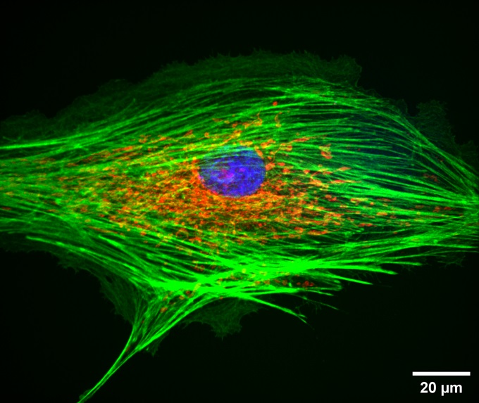 BPAE cells1-100X-SpinDisk-405&488&525